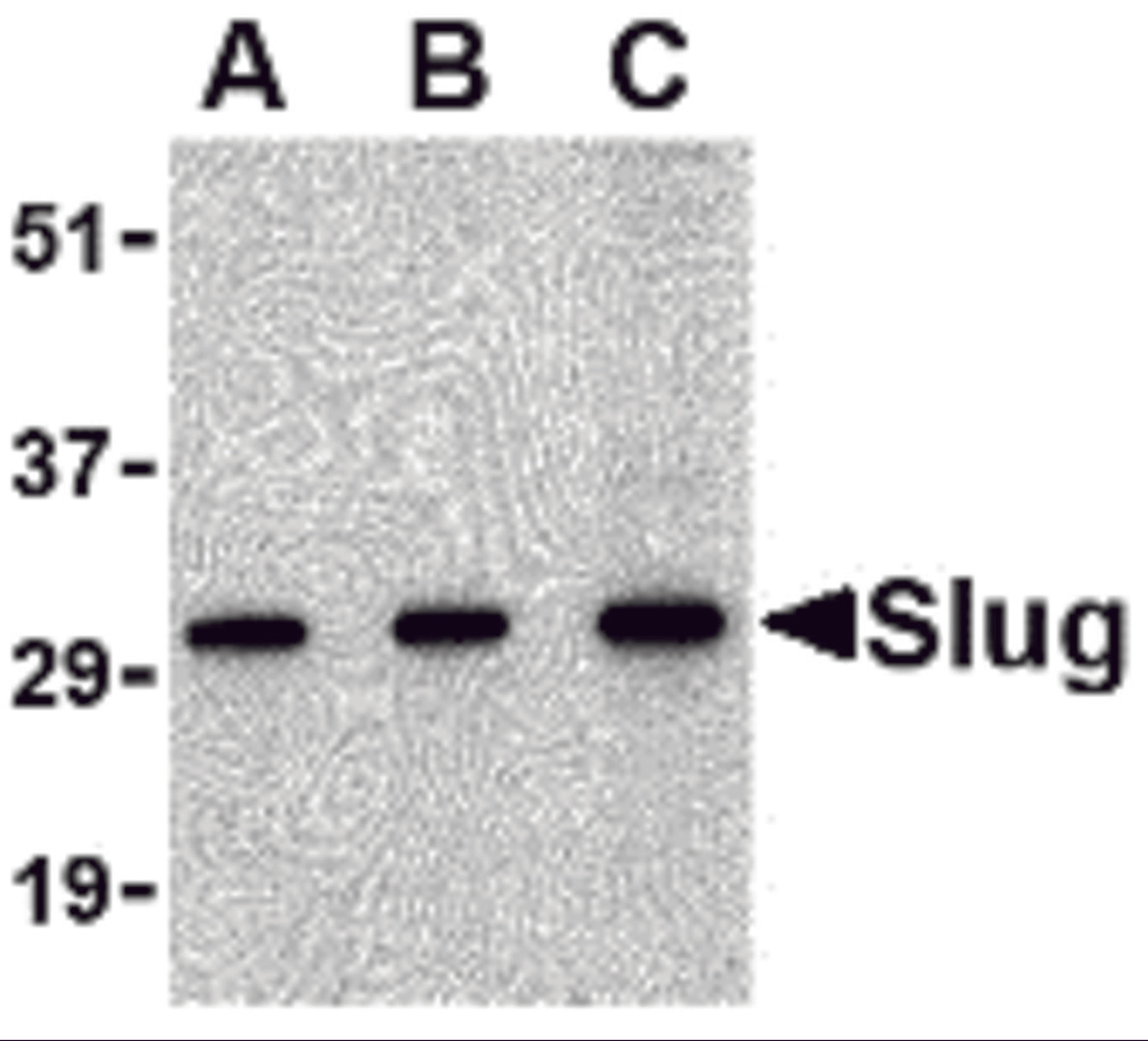 Western blot analysis of Slug in 293 cell lysate with Slug antibody at in (A) 0.5, (B) 1 and (C) 2 μg/mL.