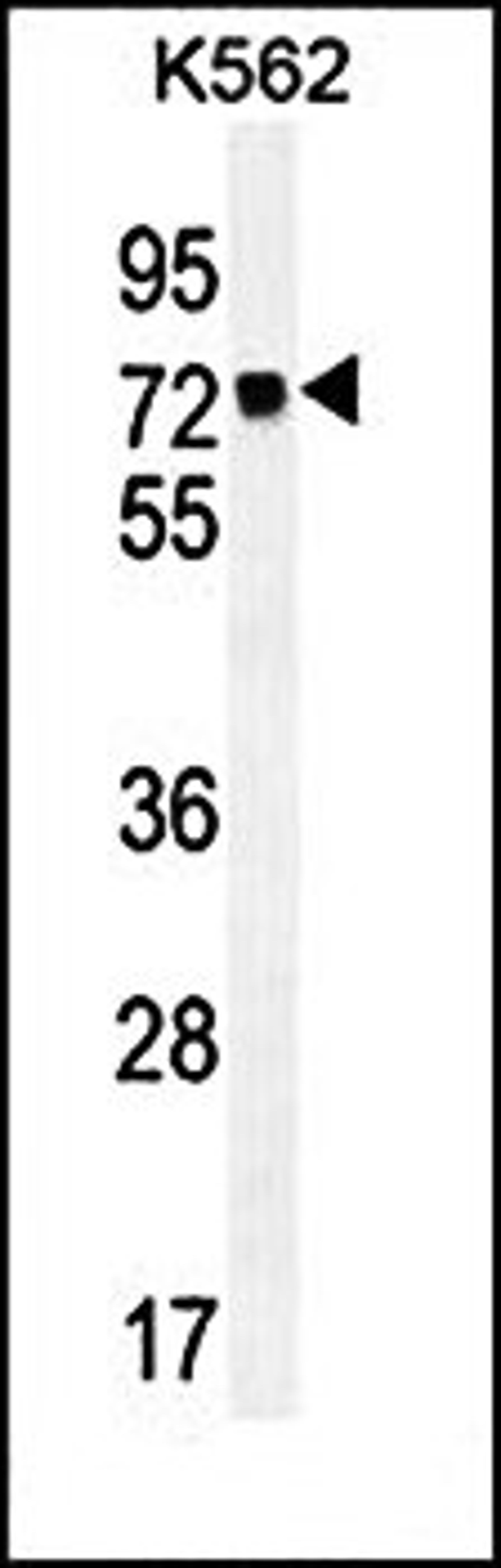 Western blot analysis of K562 cell line lysates (35ug/lane) using MLH1 antibody