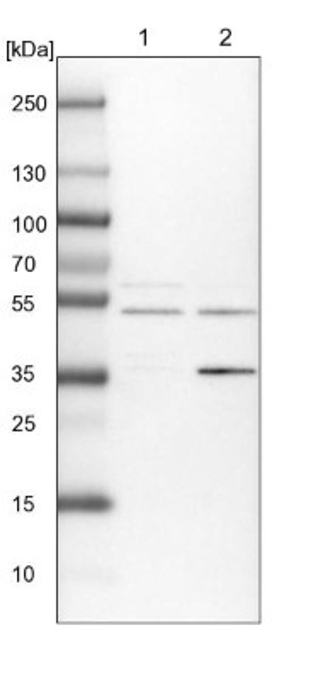 Western Blot: ACTR6 Antibody [NBP1-89000] - Lane 1: NIH-3T3 cell lysate (Mouse embryonic fibroblast cells)<br/>Lane 2: NBT-II cell lysate (Rat Wistar bladder tumour cells)