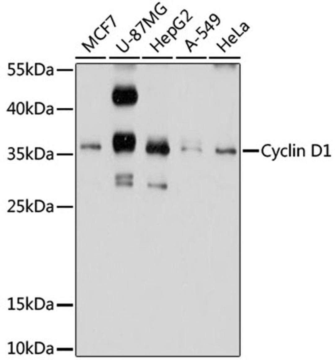 Western blot - Cyclin D1 antibody (A2708)