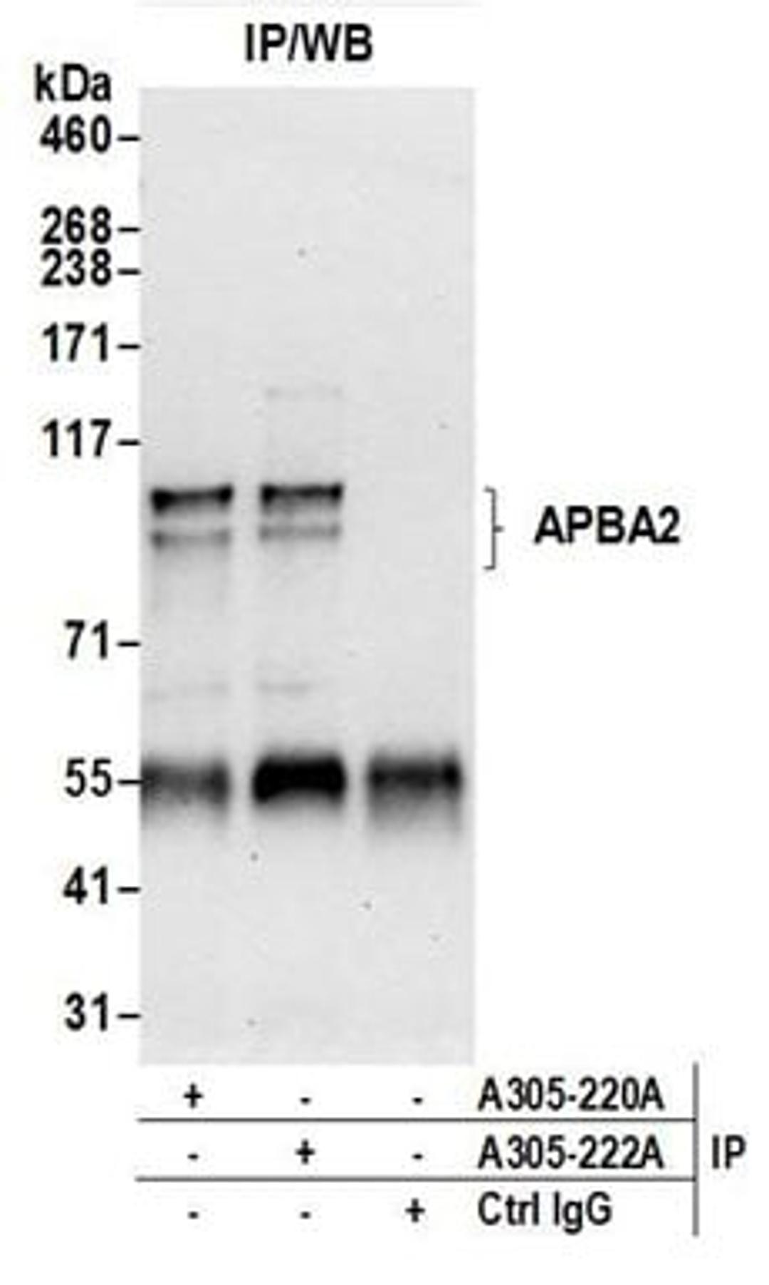 Detection of human APBA2 by western blot of immunoprecipitates.