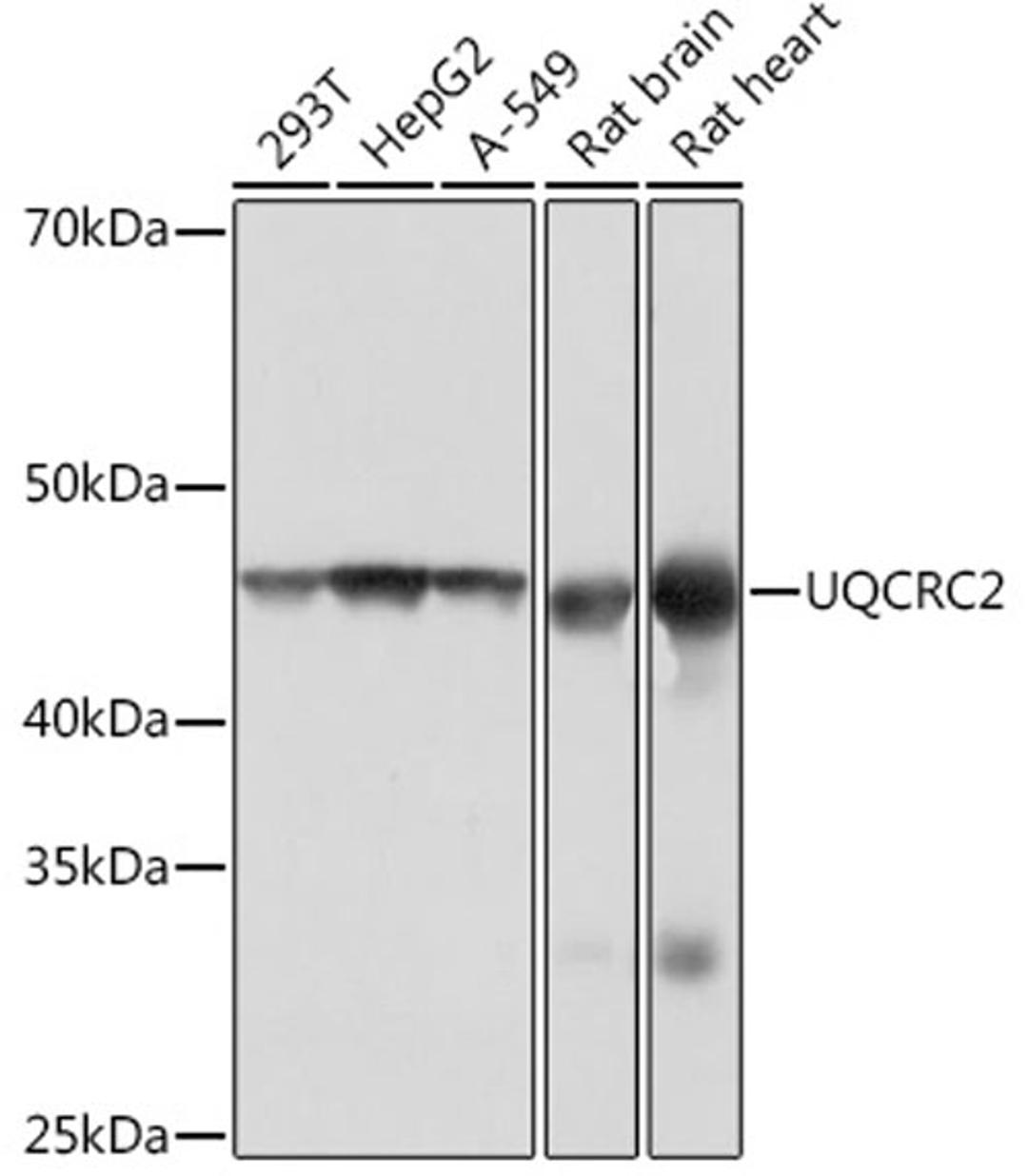 Western blot - UQCRC2  Rabbit mAb (A4366)