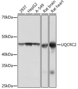 Western blot - UQCRC2  Rabbit mAb (A4366)