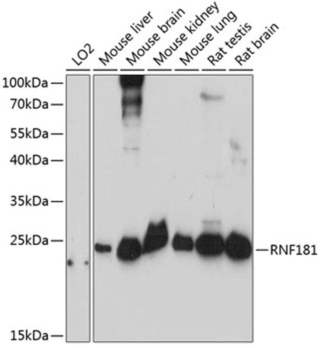 Western blot - RNF181 antibody (A14405)