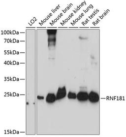 Western blot - RNF181 antibody (A14405)