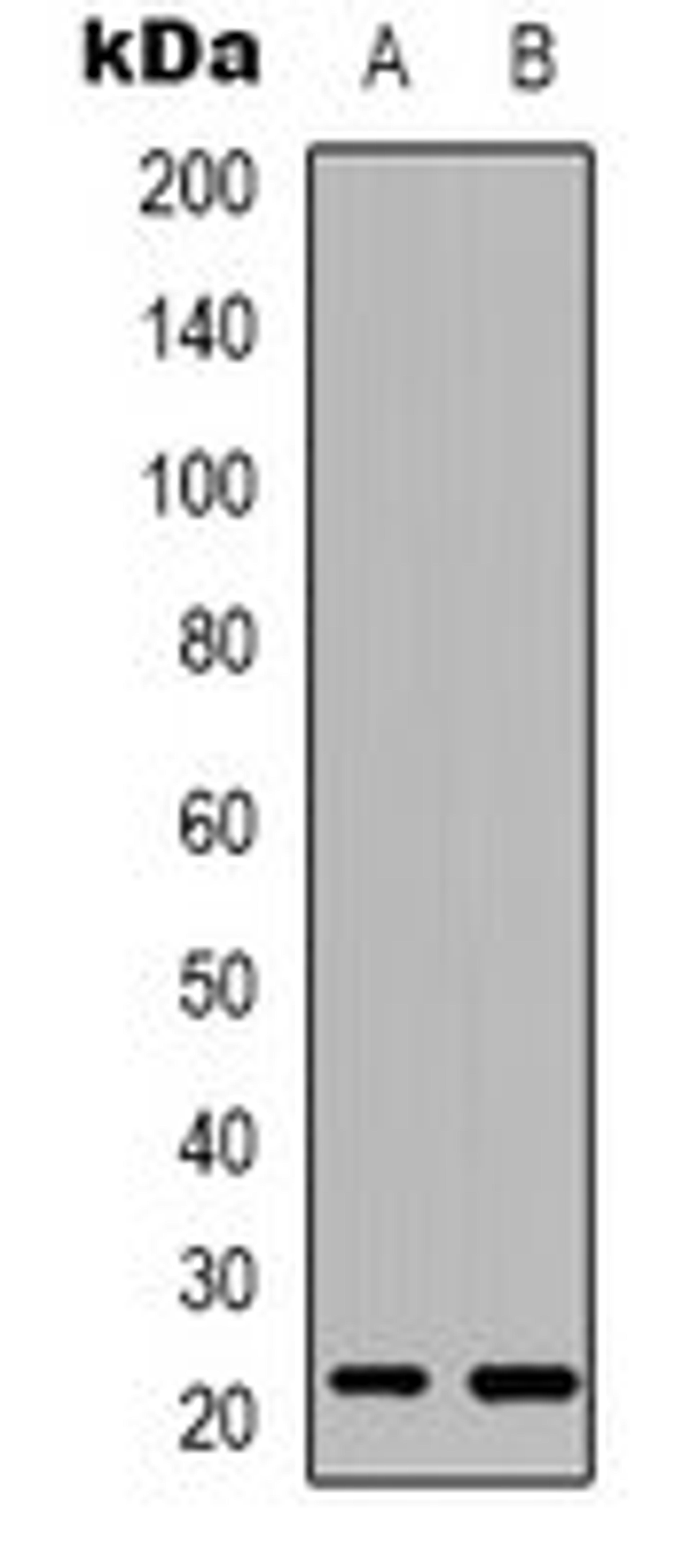 Western blot analysis of Raji (Lane 1), HuvEc (Lane 2) whole cell lysates using RAB37 antibody