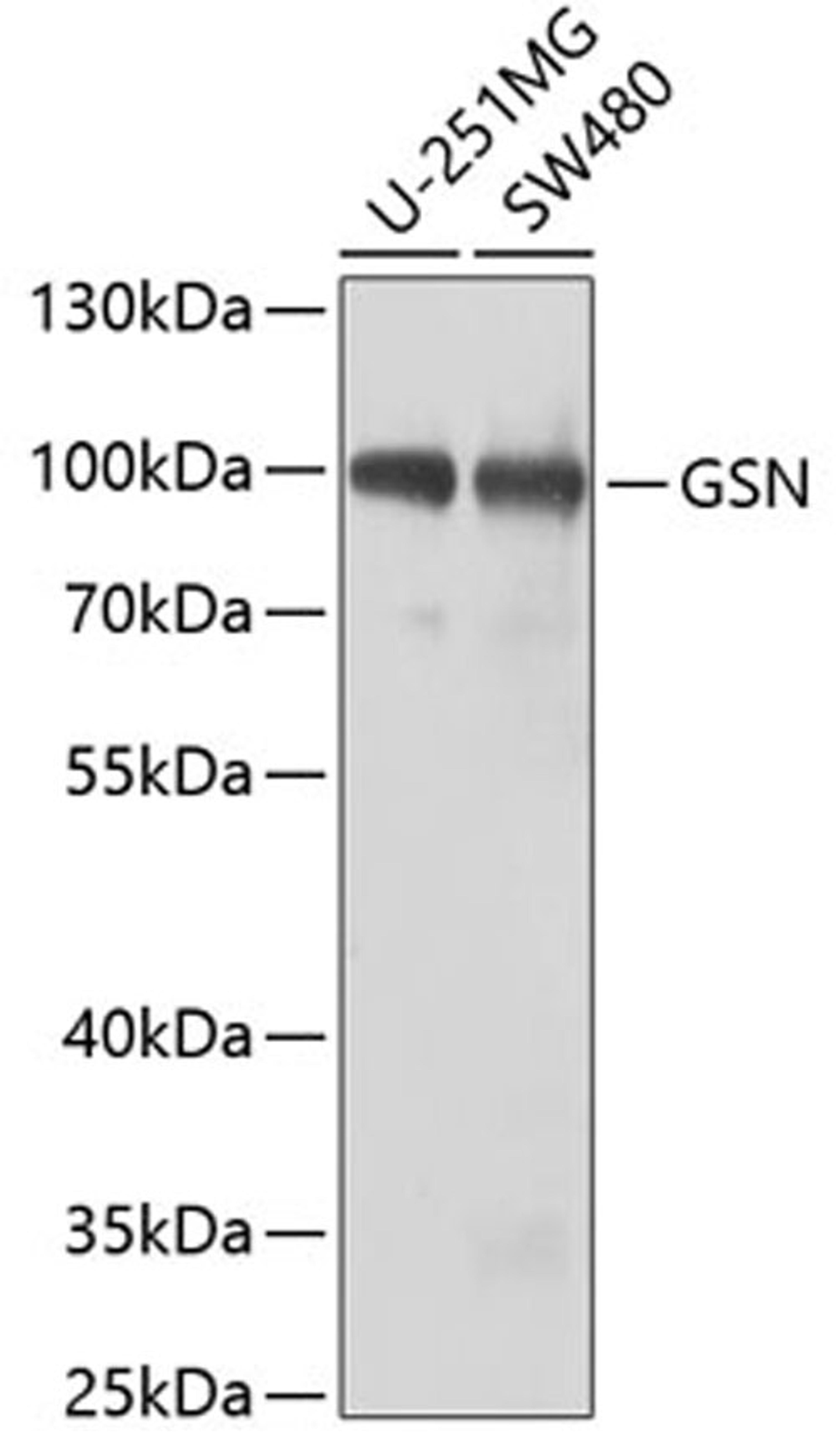 Western blot - GSN antibody (A2952)