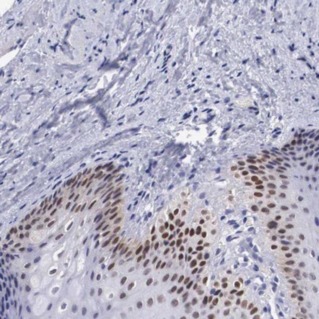 Immunohistochemistry-Paraffin: SOX11 Antibody [NBP1-85823] - Staining of human oral mucosa shows strong nuclear positivity in squamous epithelial cells.