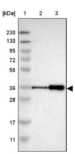 Western Blot: ZNF346 Antibody [NBP1-83084] - Lane 1: Marker [kDa] 230, 130, 95, 72, 56, 36, 28, 17, 11<br/>Lane 2: Human cell line RT-4<br/>Lane 3: Human cell line U-251MG sp