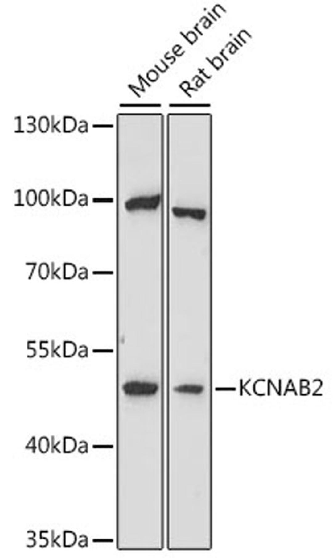 Western blot - KCNAB2 antibody (A16224)