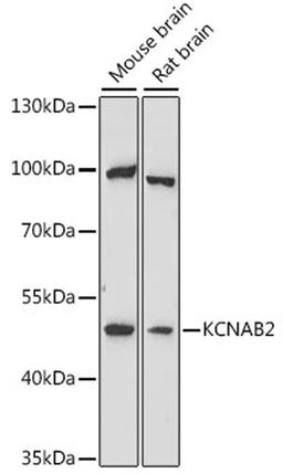 Western blot - KCNAB2 antibody (A16224)