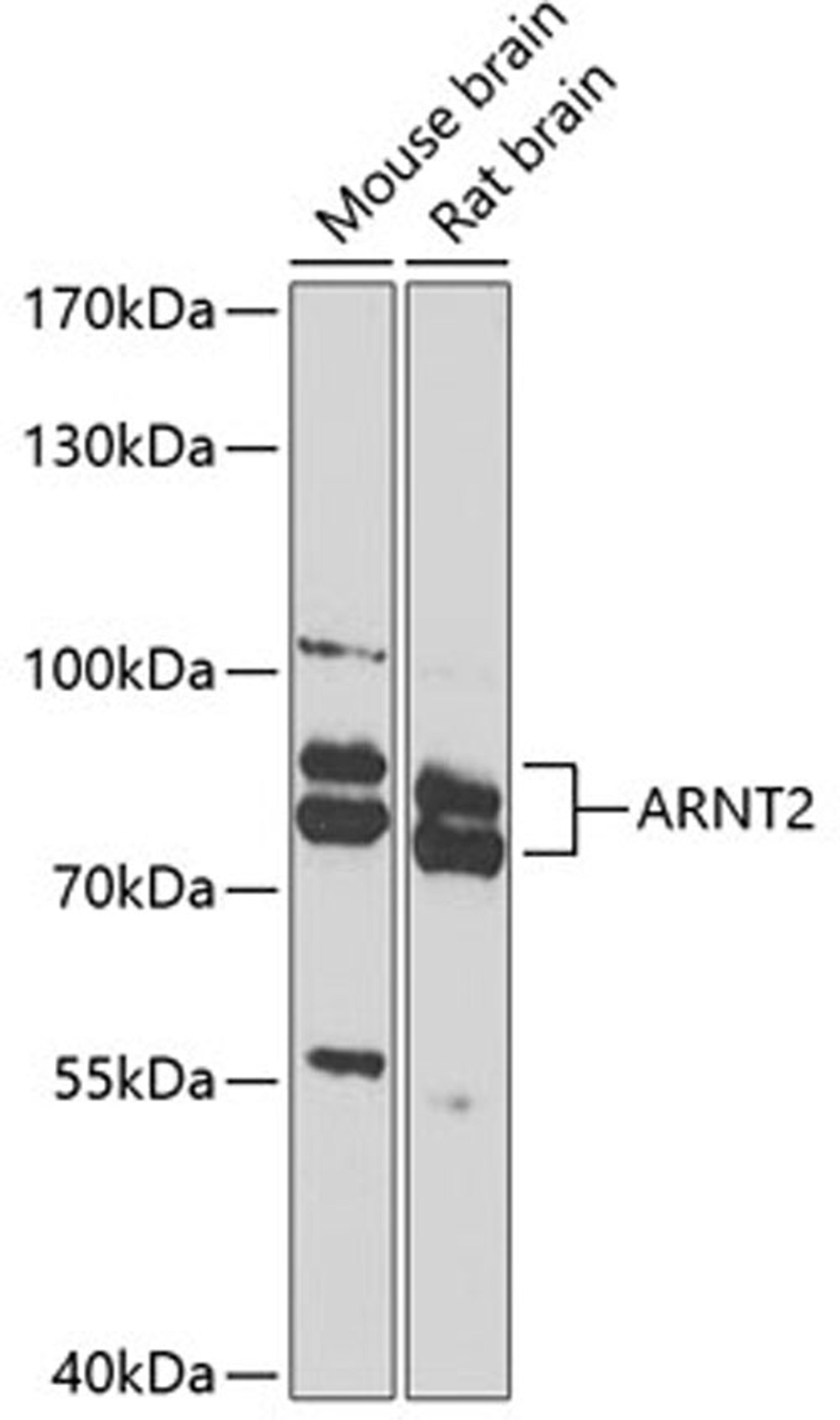 Western blot - ARNT2 antibody (A8060)