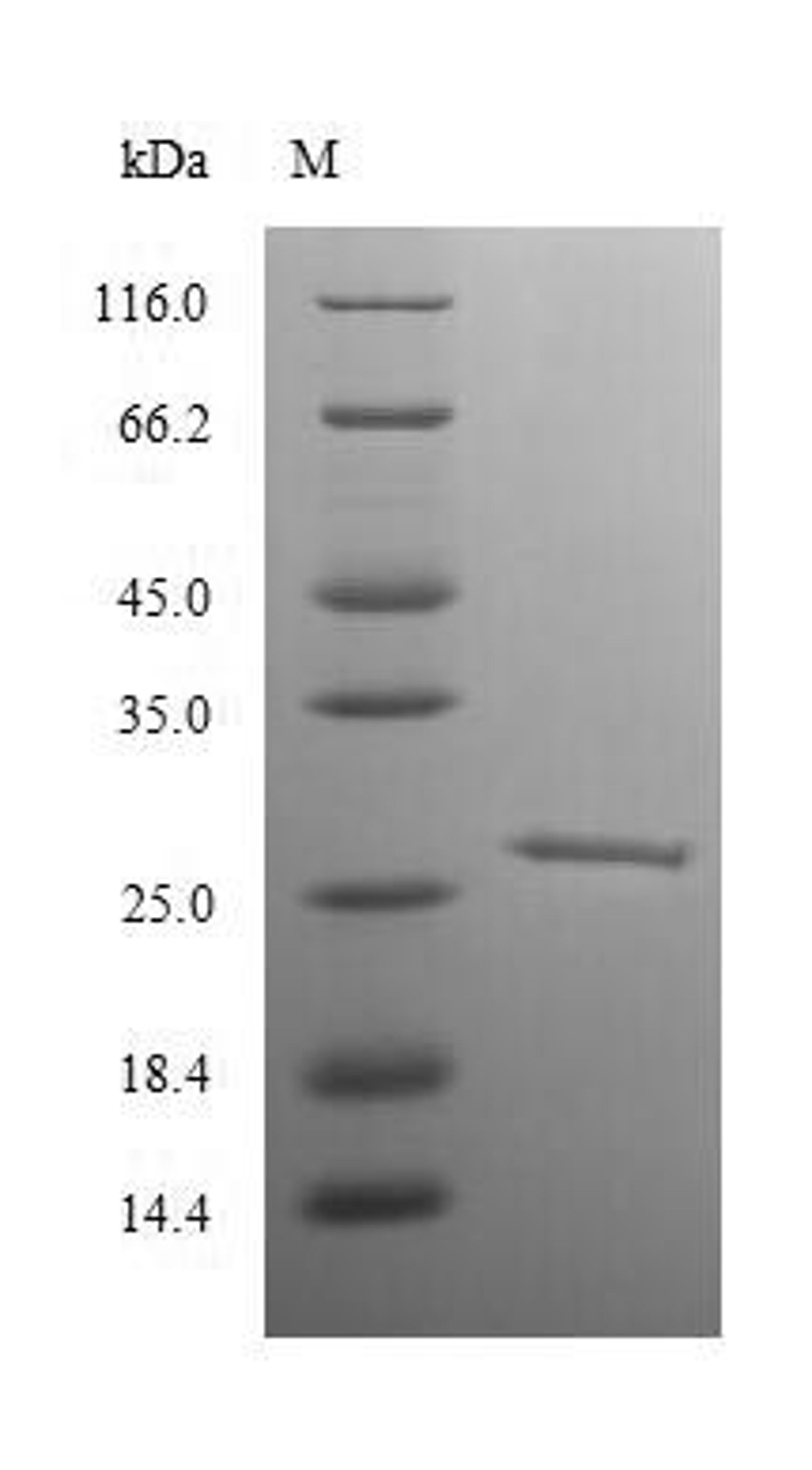 (Tris-Glycine gel) Discontinuous SDS-PAGE (reduced) with 5% enrichment gel and 15% separation gel.