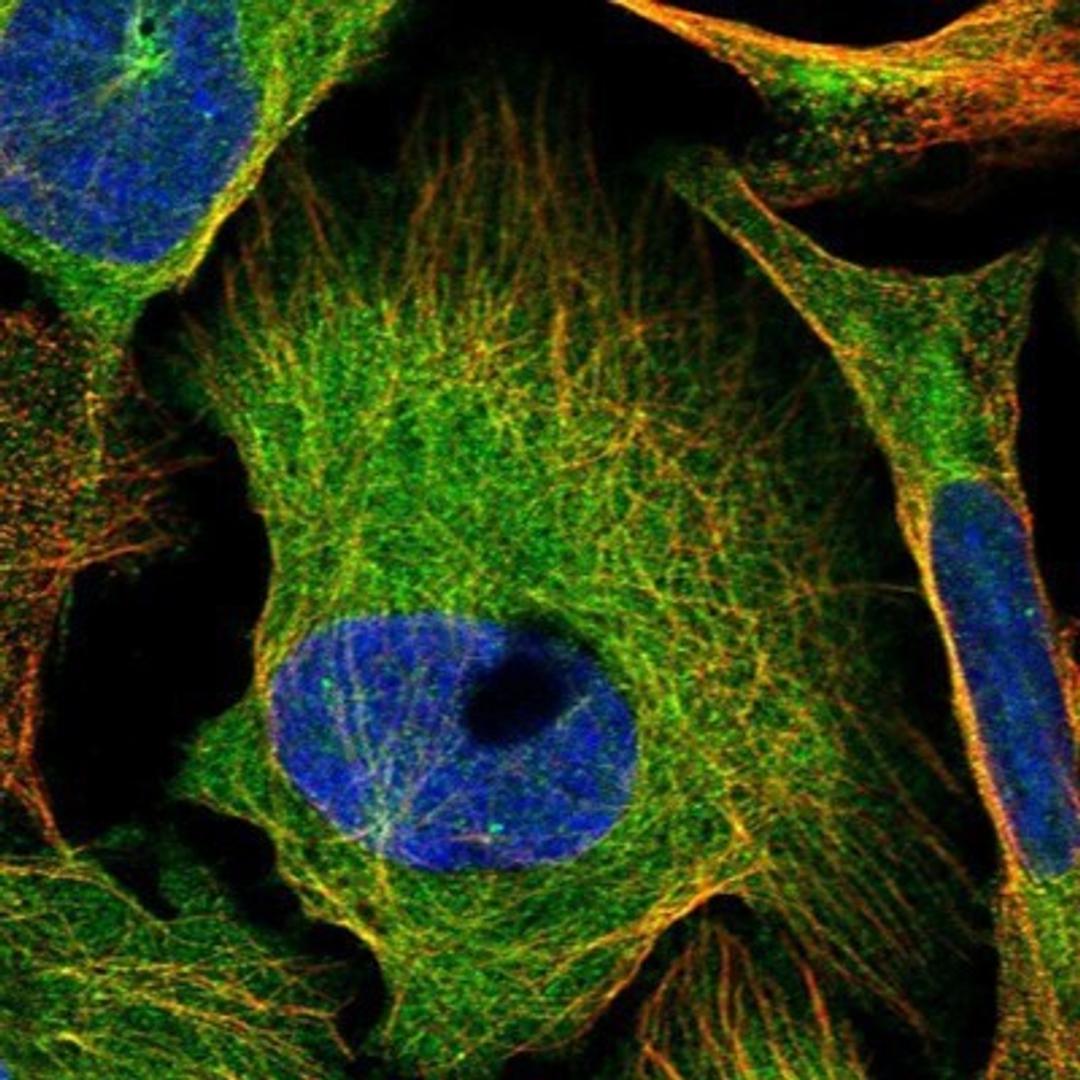 Immunocytochemistry/Immunofluorescence: S100 calcium binding protein A14 Antibody [NBP1-90000] - Staining of human cell line U-2 OS shows positivity in cytoplasm & cytoskeleton (microtubules).