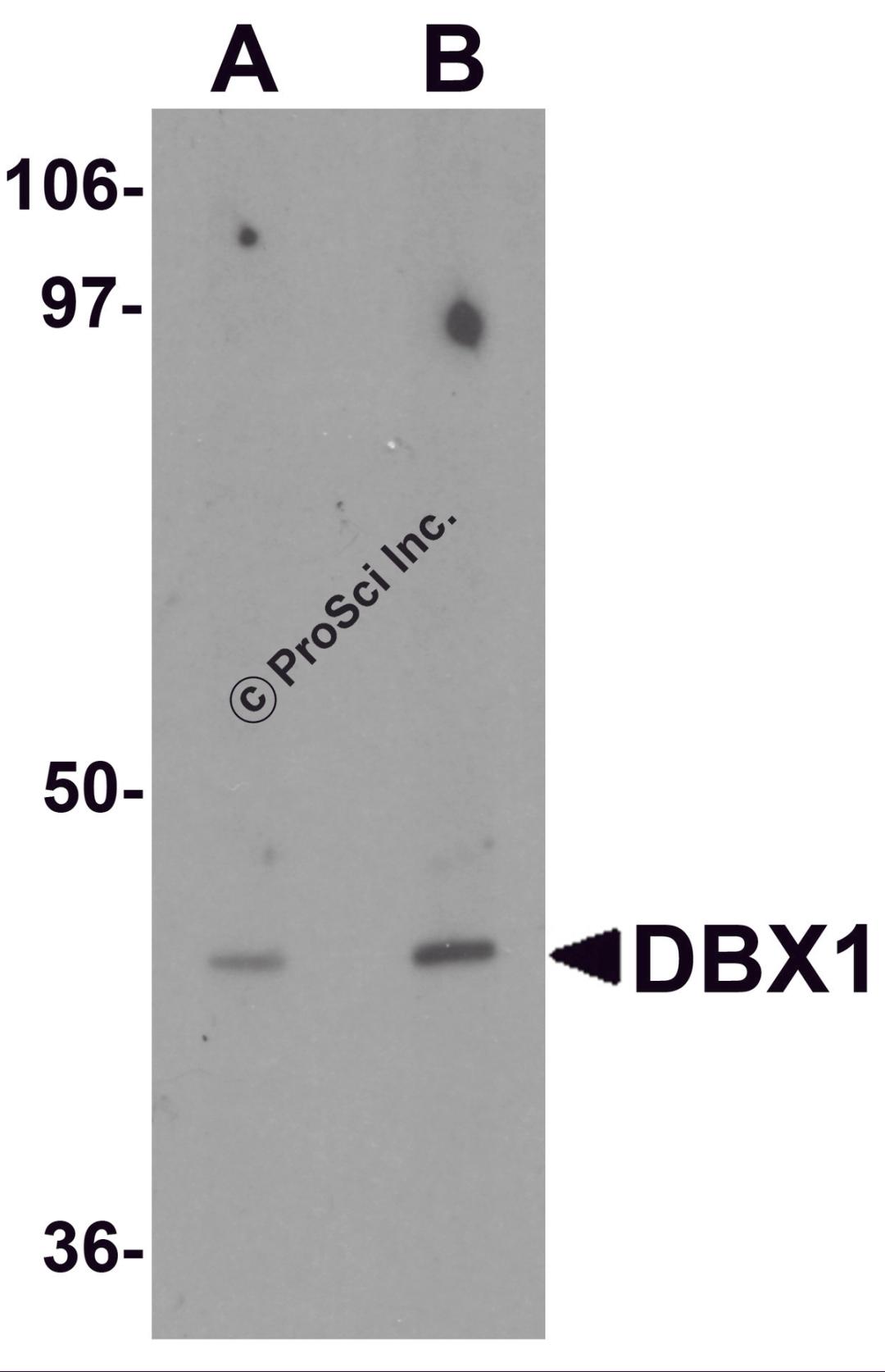 Western blot analysis of DBX1 in mouse kidney tissue lysate with DBX1 antibody at (A) 1 and (B) 2 &#956;g/mL.