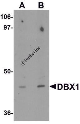 Western blot analysis of DBX1 in mouse kidney tissue lysate with DBX1 antibody at (A) 1 and (B) 2 μg/mL.