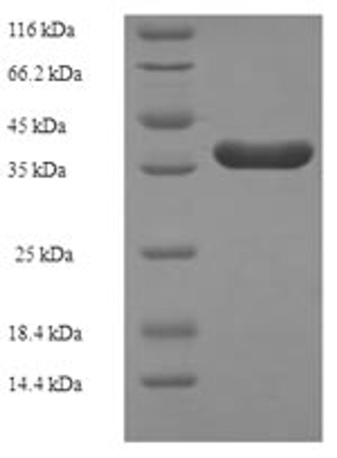 (Tris-Glycine gel) Discontinuous SDS-PAGE (reduced) with 5% enrichment gel and 15% separation gel.
