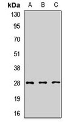 Western blot analysis of Jurkat (Lane1), Hela (Lane2), mouse lung (Lane3) whole cell lysates using SNRPA1 antibody