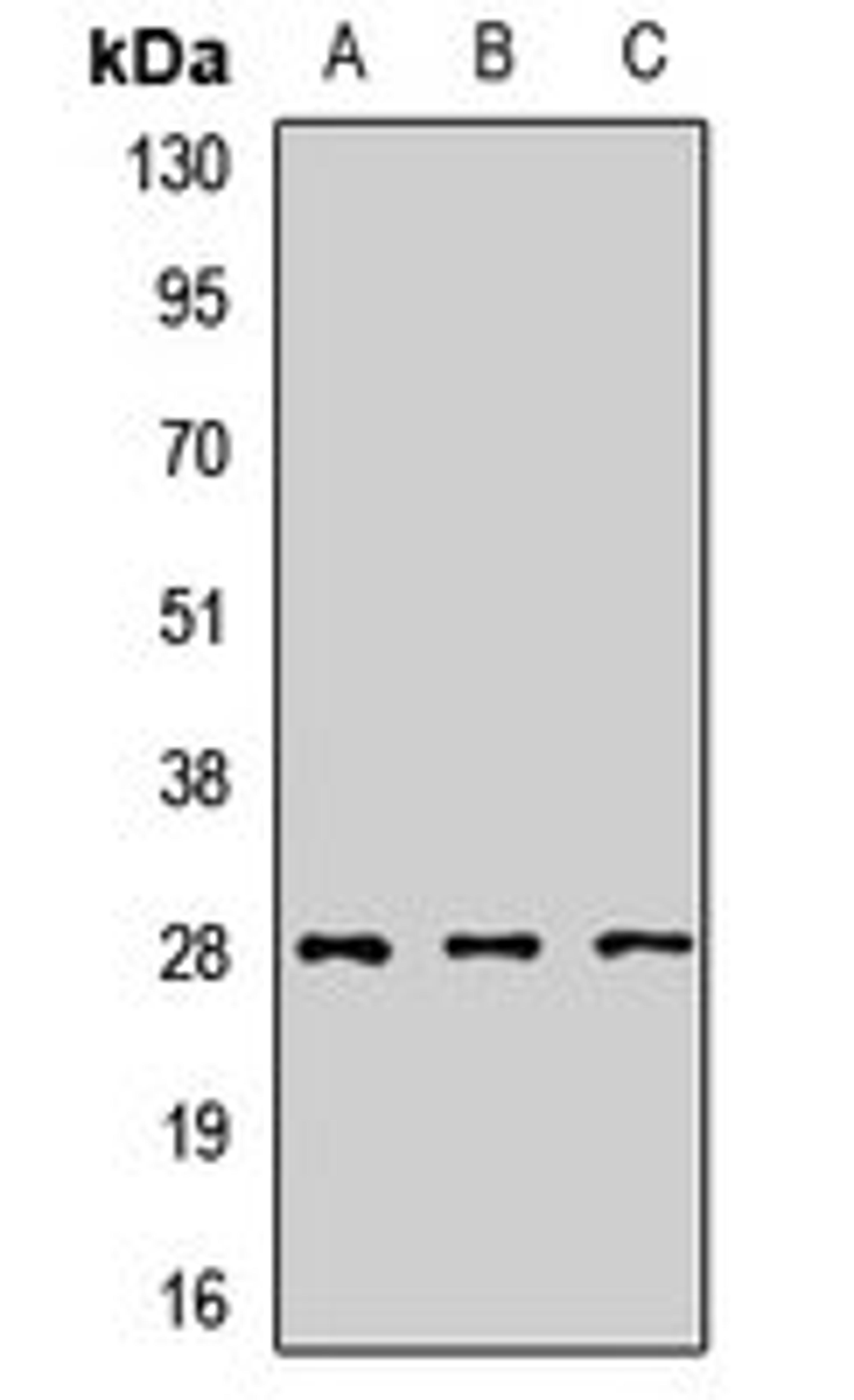 Western blot analysis of Jurkat (Lane1), Hela (Lane2), mouse lung (Lane3) whole cell lysates using SNRPA1 antibody