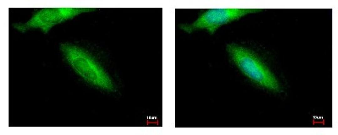 Immunocytochemistry/Immunofluorescence: HIP-55 Antibody [NBP1-31026] - Sample: HeLa cells were fixed in iced-cold MeOH for 5 min. Green: DBNL protein stained by HIP55 antibody, N-term diluted at 1:500. Blue: Hoechst 33343 staining.