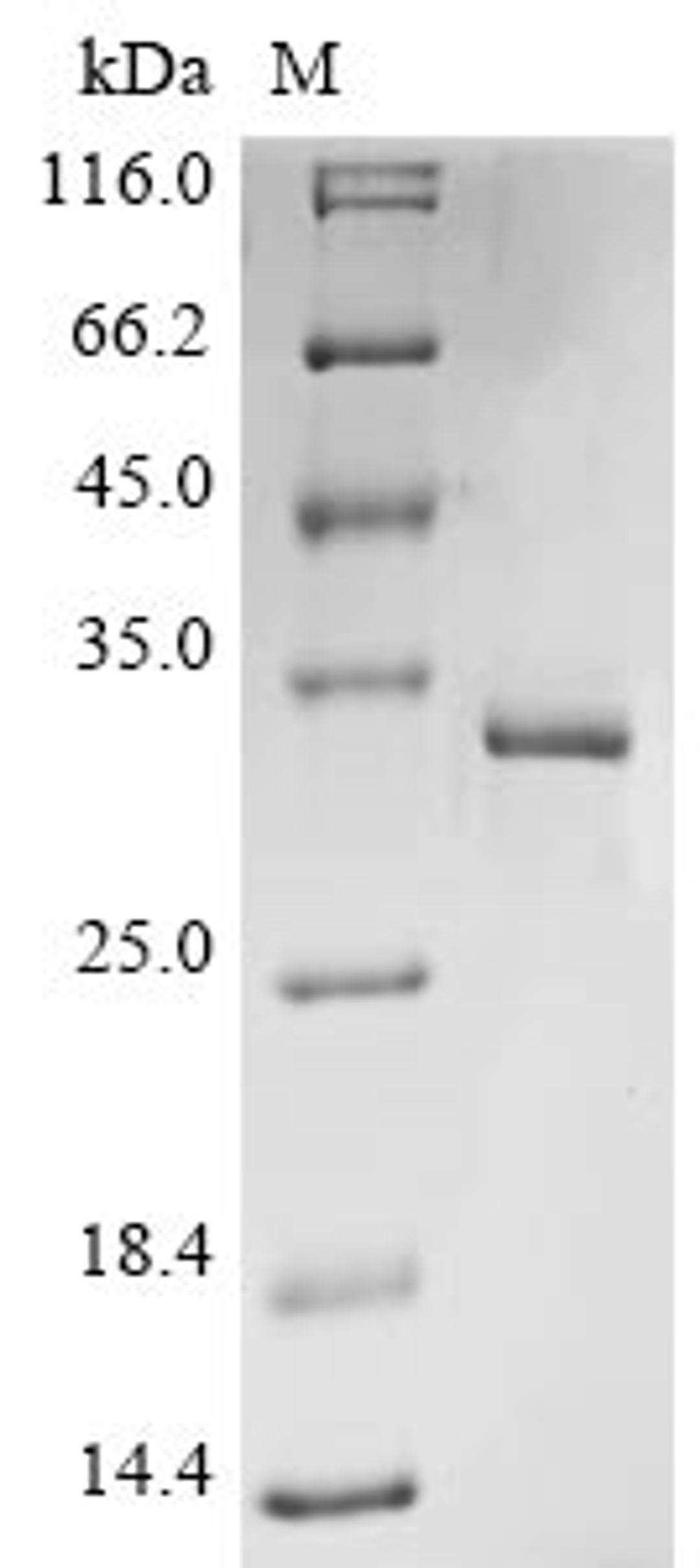 (Tris-Glycine gel) Discontinuous SDS-PAGE (reduced) with 5% enrichment gel and 15% separation gel.