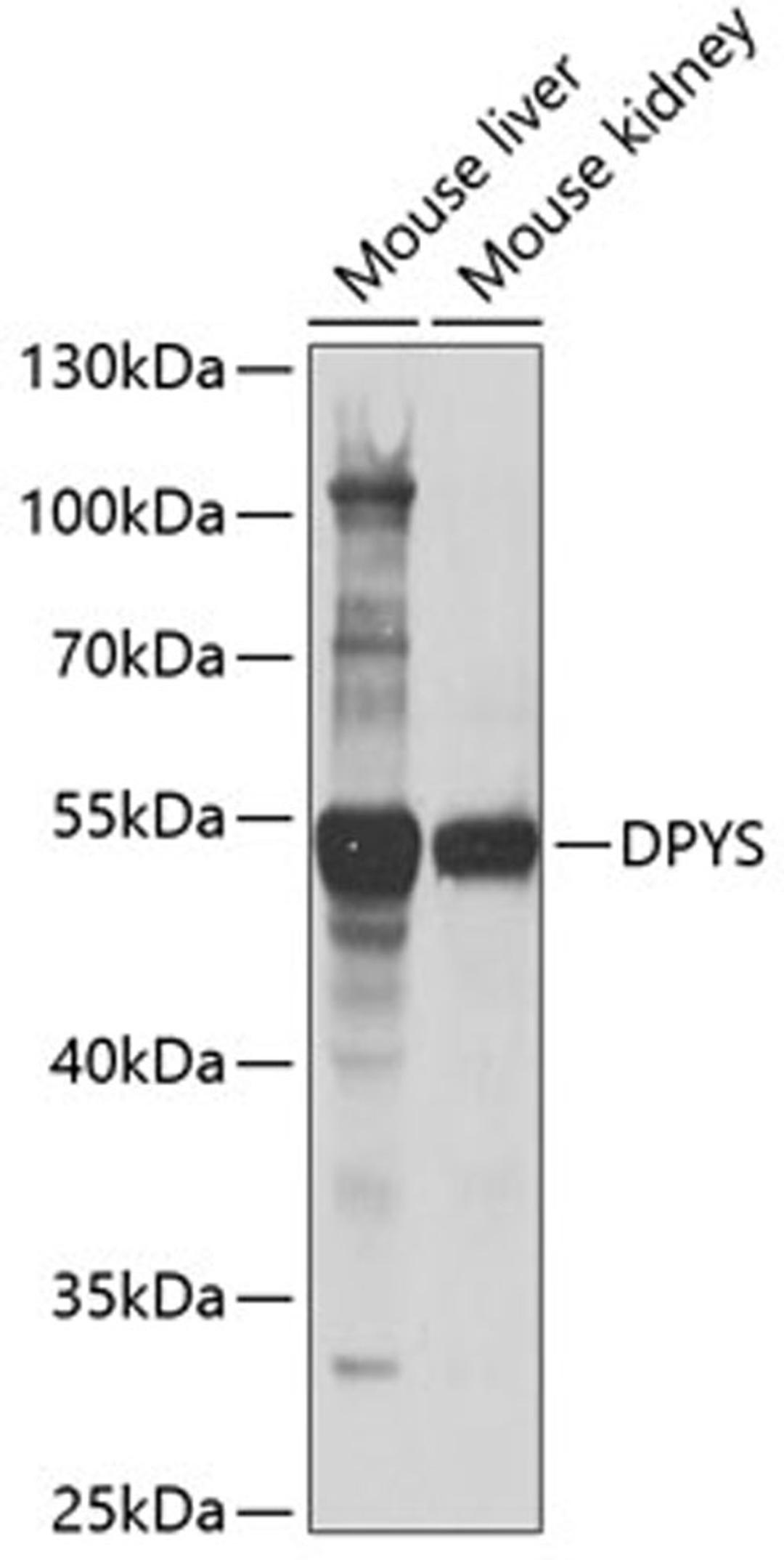 Western blot - DPYS antibody (A6368)