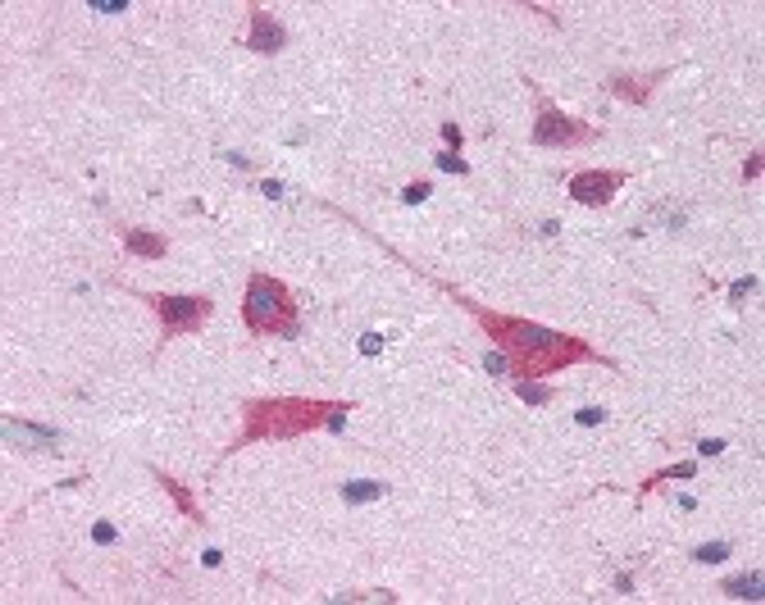 Immunohistochemistry staining of EIF4G2 in brain cortex tissue using EIF4G2 monoclonal Antibody.