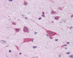 Immunohistochemistry staining of EIF4G2 in brain cortex tissue using EIF4G2 monoclonal Antibody.