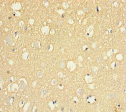 Immunohistochemistry of paraffin-embedded human brain tissue using CSB-PA021334LA01HU at dilution of 1:100