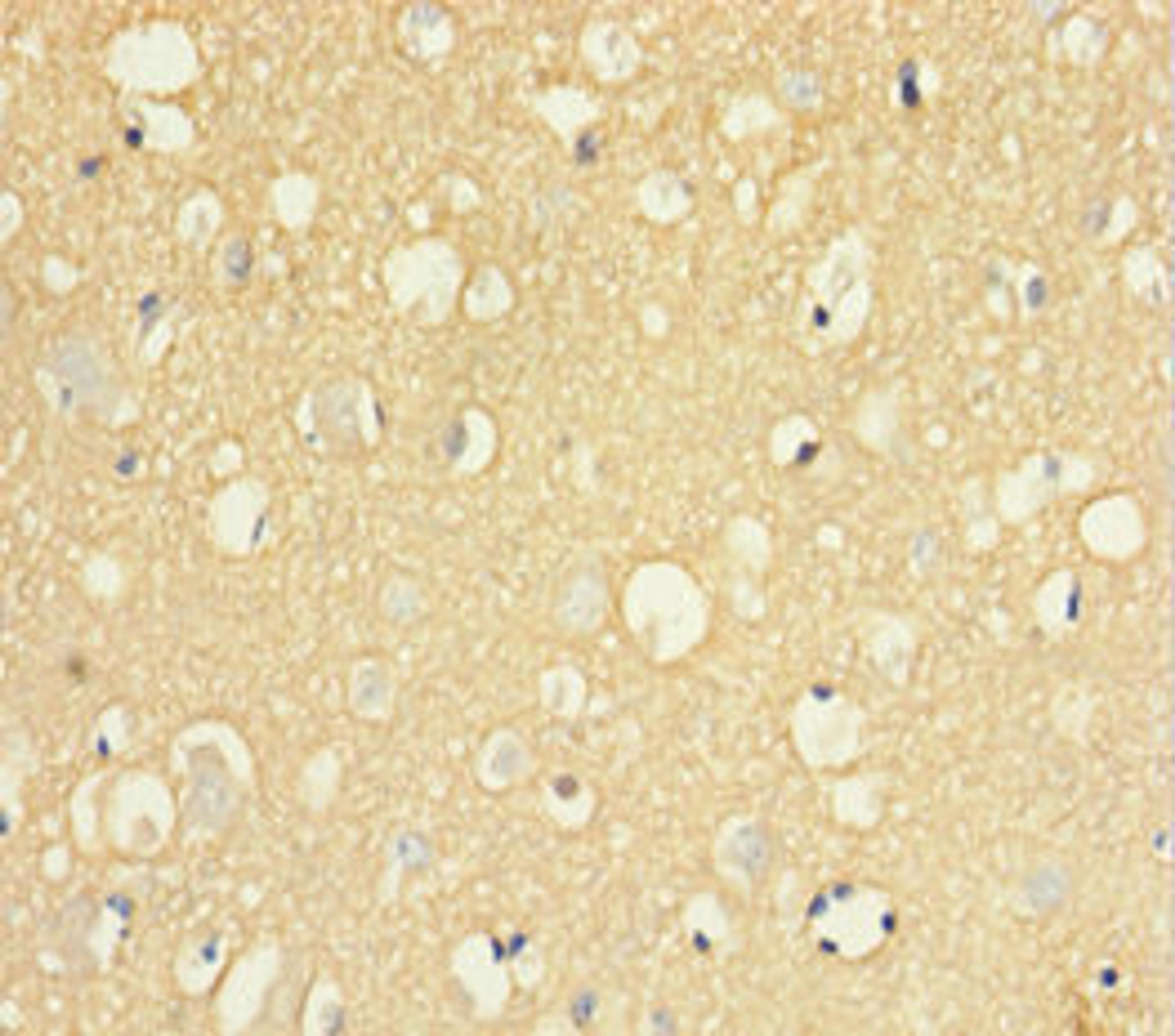 Immunohistochemistry of paraffin-embedded human brain tissue using CSB-PA021334LA01HU at dilution of 1:100