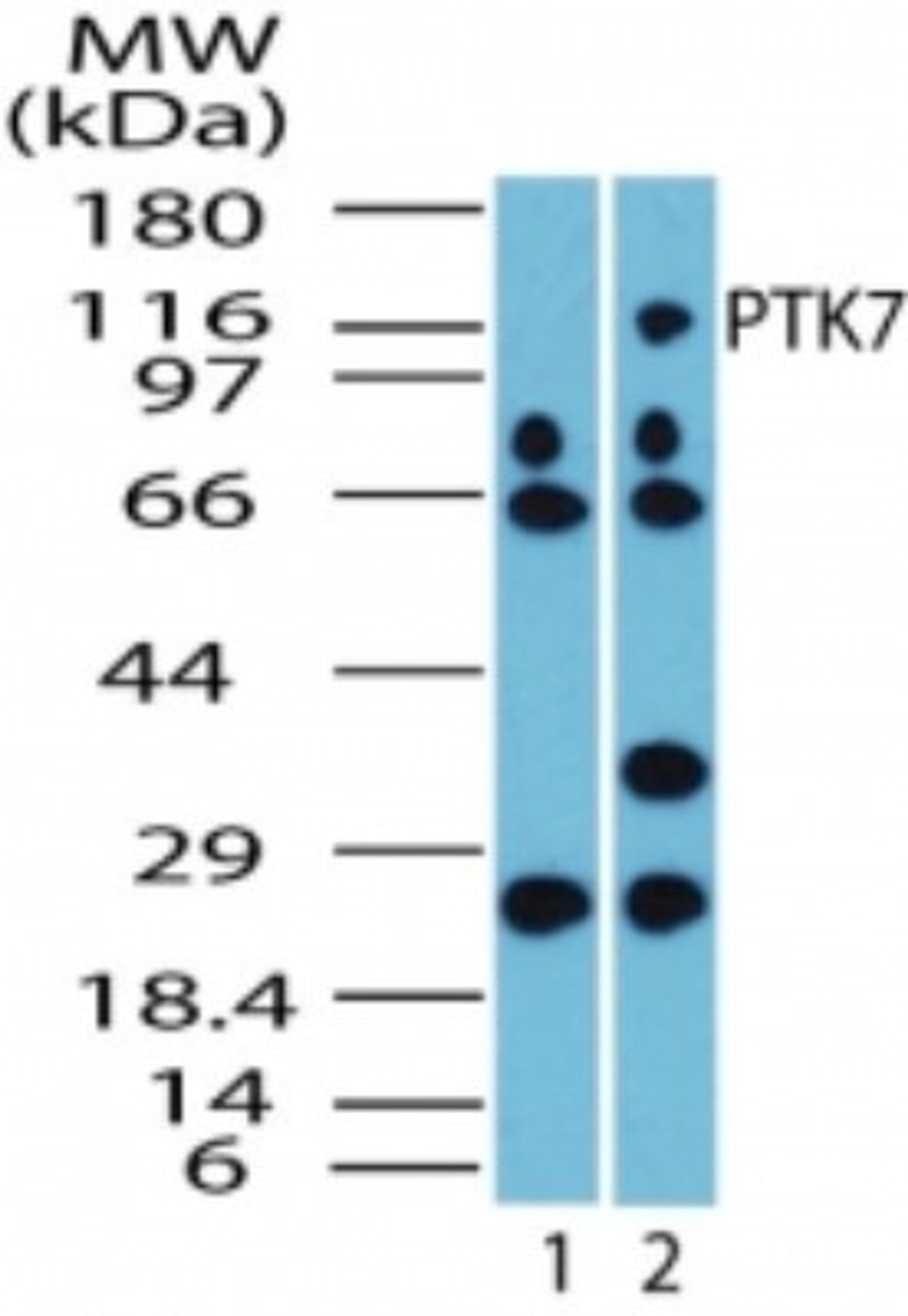 Western Blot: CCK4 Antibody [NBP2-23655] - Analysis of PTK7 in HCT116 cell lysate. Lane 1 shows pre-immune sera. Lane 2 shows this antibody tested at 1:2500 dilution.