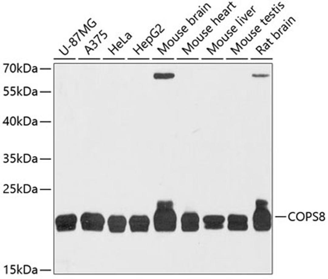 Western blot - COPS8 antibody (A12745)