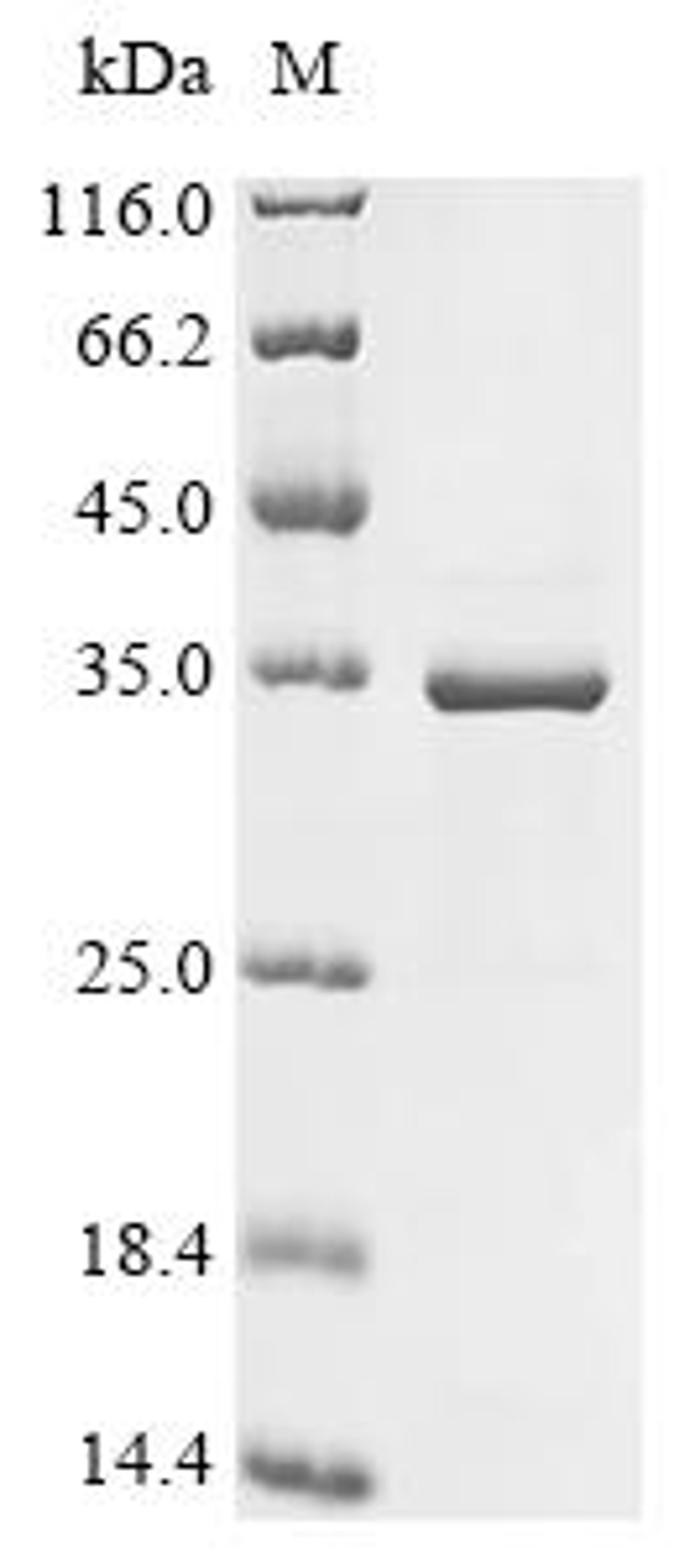 (Tris-Glycine gel) Discontinuous SDS-PAGE (reduced) with 5% enrichment gel and 15% separation gel.