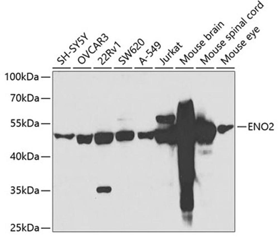 Western blot - ENO2 antibody (A3118)