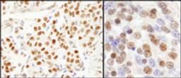 Detection of human and mouse SF3a120/SAP114 by immunohistochemistry.