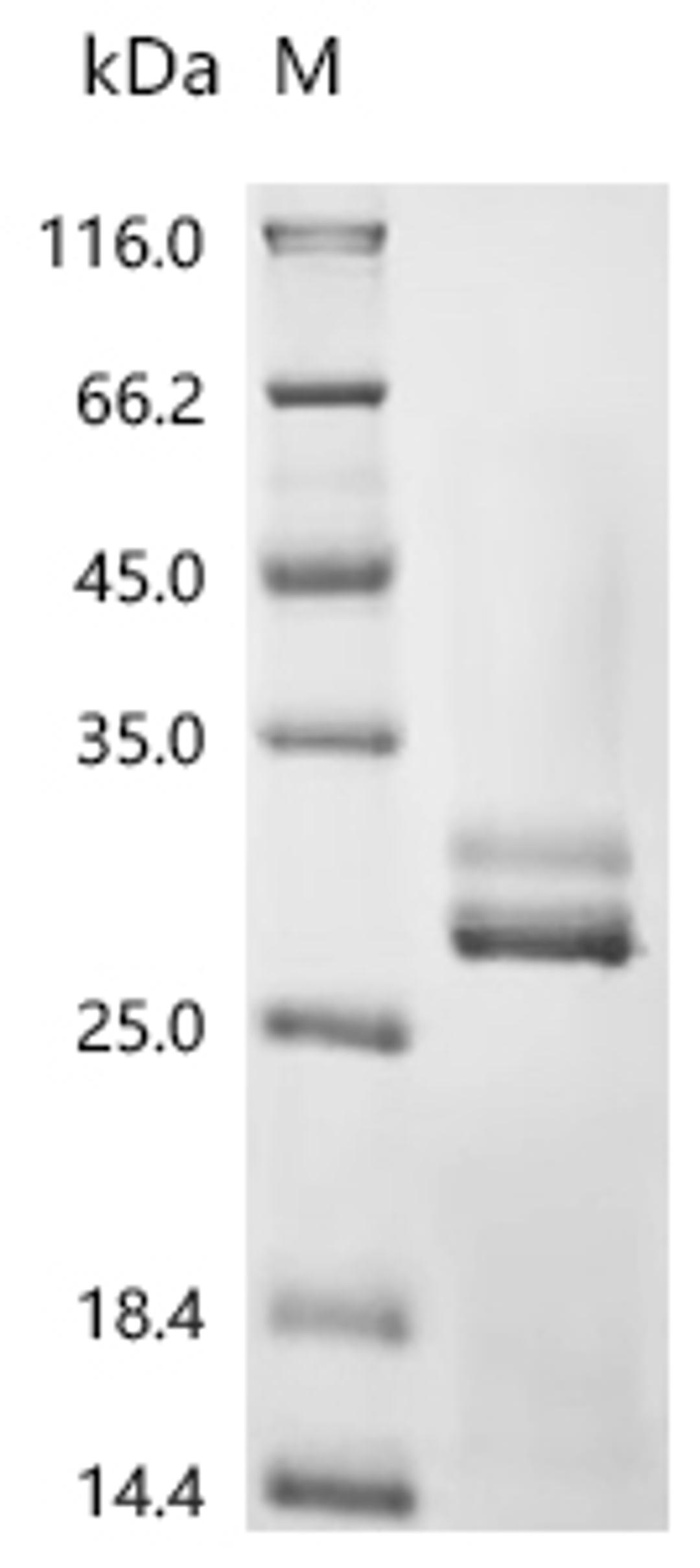 (Tris-Glycine gel) Discontinuous SDS-PAGE (reduced) with 5% enrichment gel and 15% separation gel.