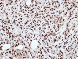 Immunohistochemistry-Paraffin: DDX39 Antibody [NBP2-16134] - Immunohistochemical analysis of paraffin-embedded A549 xenograft, using antibody at 1:250 dilution.