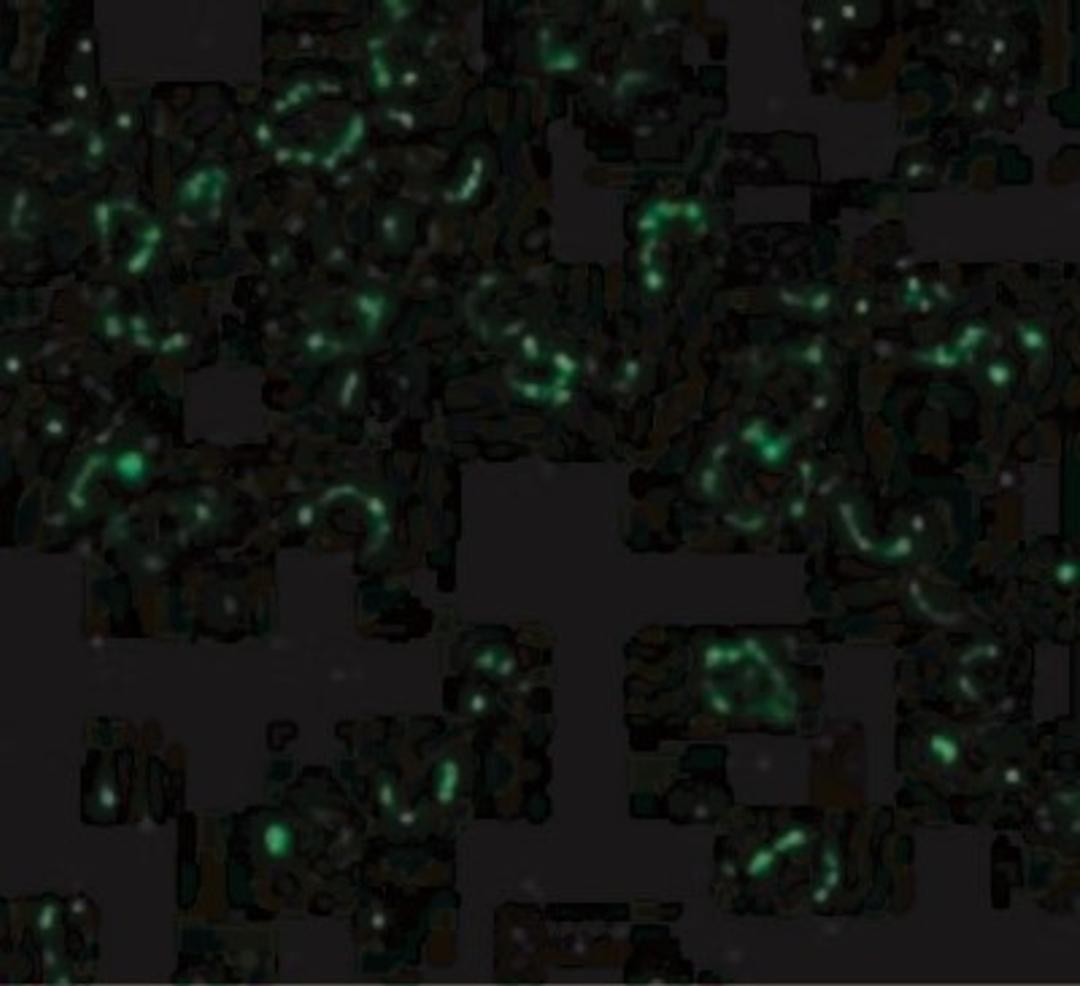 Immunocytochemistry/Immunofluorescence: CARD10 Antibody [NBP1-76676] - Immunofluorescence of CARD10 in EL4 cells with CARD10 antibody at 20 ug/mL.