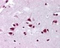 Immunohistochemistry-Paraffin: FMNL2 Antibody [NBP2-24748] - Analysisof human brain, cortex using this antibody at 10 ug/ml.