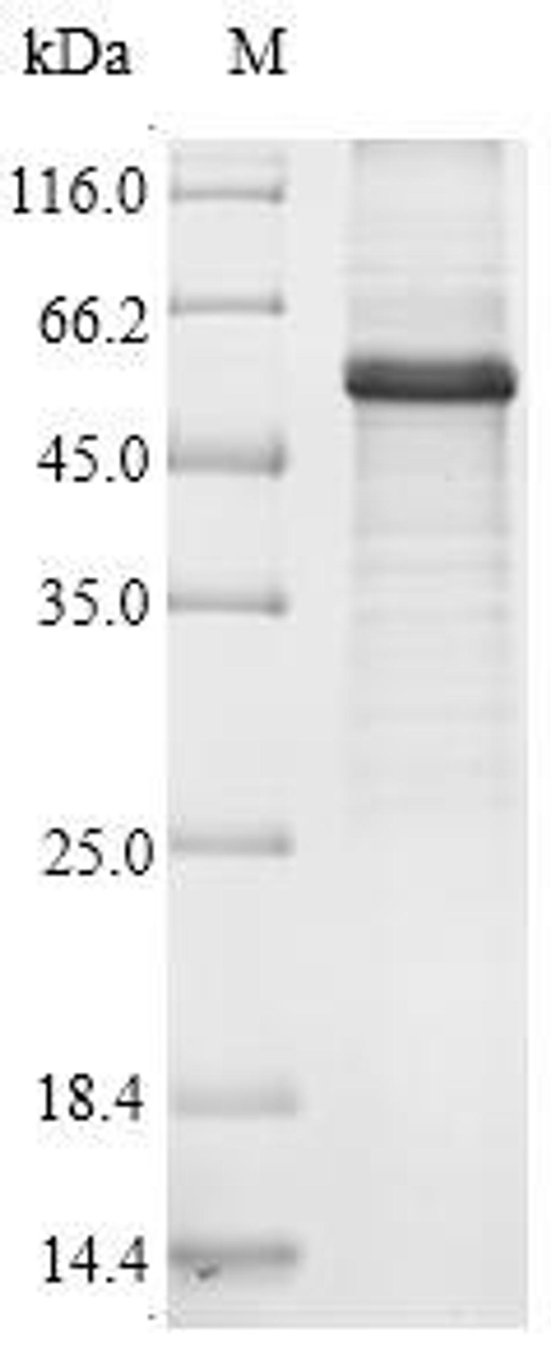 (Tris-Glycine gel) Discontinuous SDS-PAGE (reduced) with 5% enrichment gel and 15% separation gel.