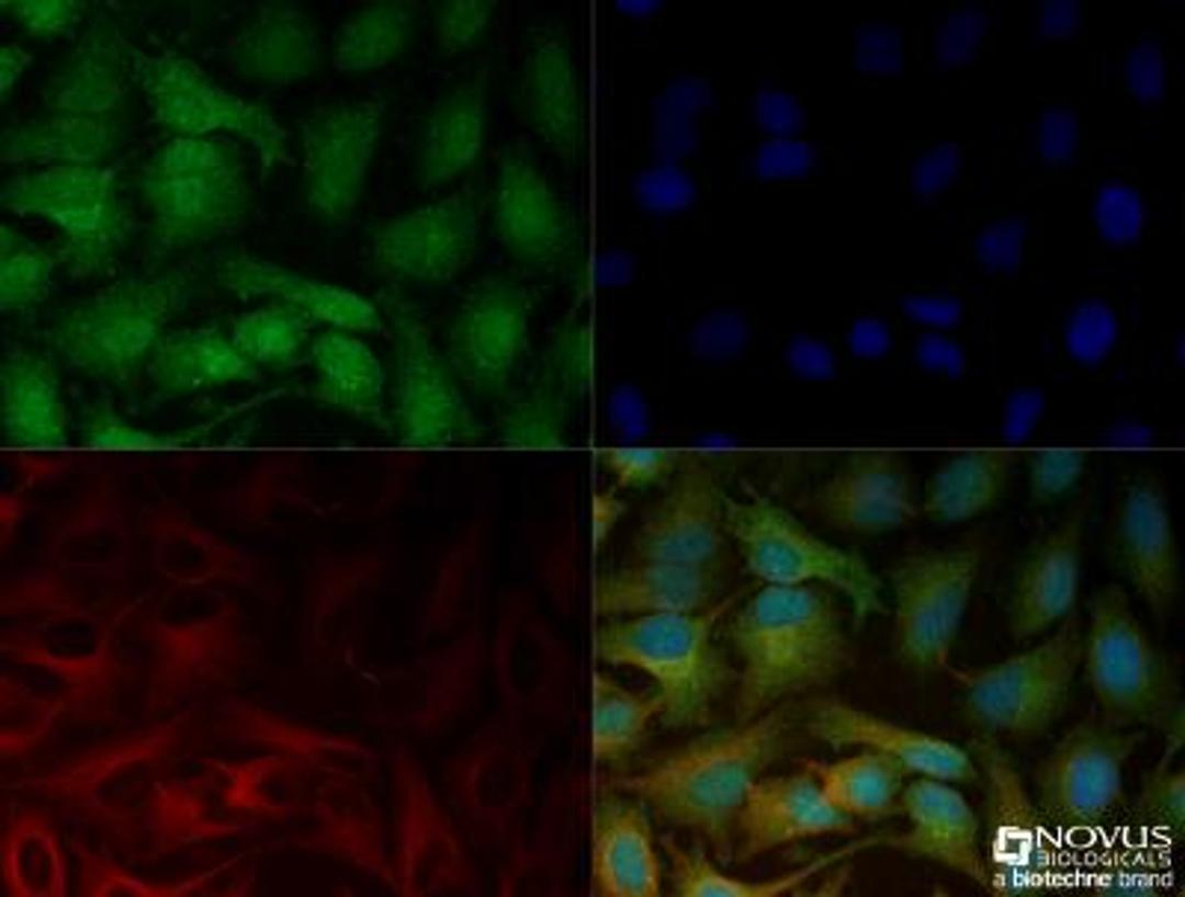 Immunocytochemistry/Immunofluorescence: LOX Antibody [NBP2-24877] - HeLa cells were fixed for 10 minutes using 10% formalin and then permeabilized for 5 minutes using 1X TBS + 0.5% Triton-X100. The cells were incubated with anti-LOX (NBP2-24877) at a 1:200 dilution overnight at 4C and detected with an anti-rabbit Dylight 488 (Green) at a 1:500 dilution. Alpha tubulin was used as a co-stain at a 1:1000 dilution and detected with an anti-mouse Dylight 550 (Red) at a 1:500 dilution. Nuclei were counterstained with DAPI (Blue). Cells were imaged using a 40X objective.