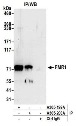 Detection of human FMR1 by western blot of immunoprecipitates.