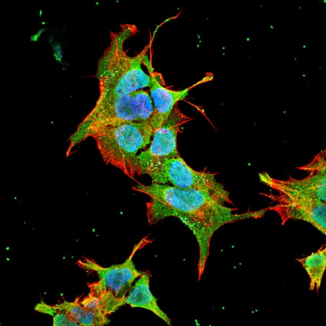 Immunofluorescence analysis of neuroblastoma cell line sk-n-be using Ankyrin R antibody