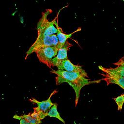 Immunofluorescence analysis of neuroblastoma cell line sk-n-be using Ankyrin R antibody