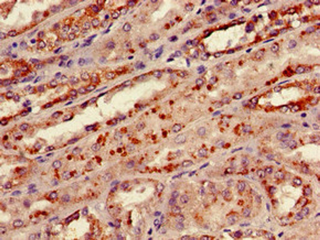Immunohistochemistry of paraffin-embedded human kidney tissue using CSB-PA14647D0Rb at dilution of 1:100