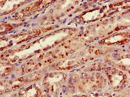 Immunohistochemistry of paraffin-embedded human kidney tissue using CSB-PA14647D0Rb at dilution of 1:100