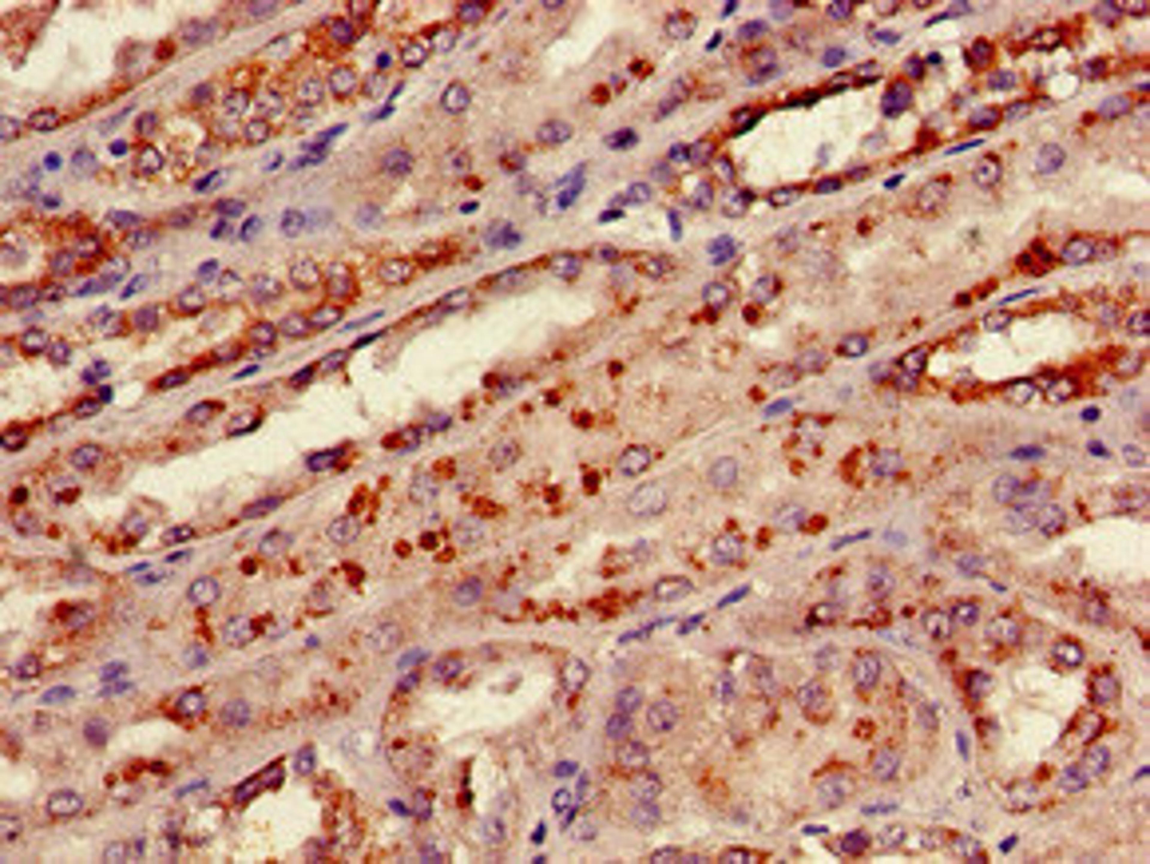 Immunohistochemistry of paraffin-embedded human kidney tissue using CSB-PA14647D0Rb at dilution of 1:100