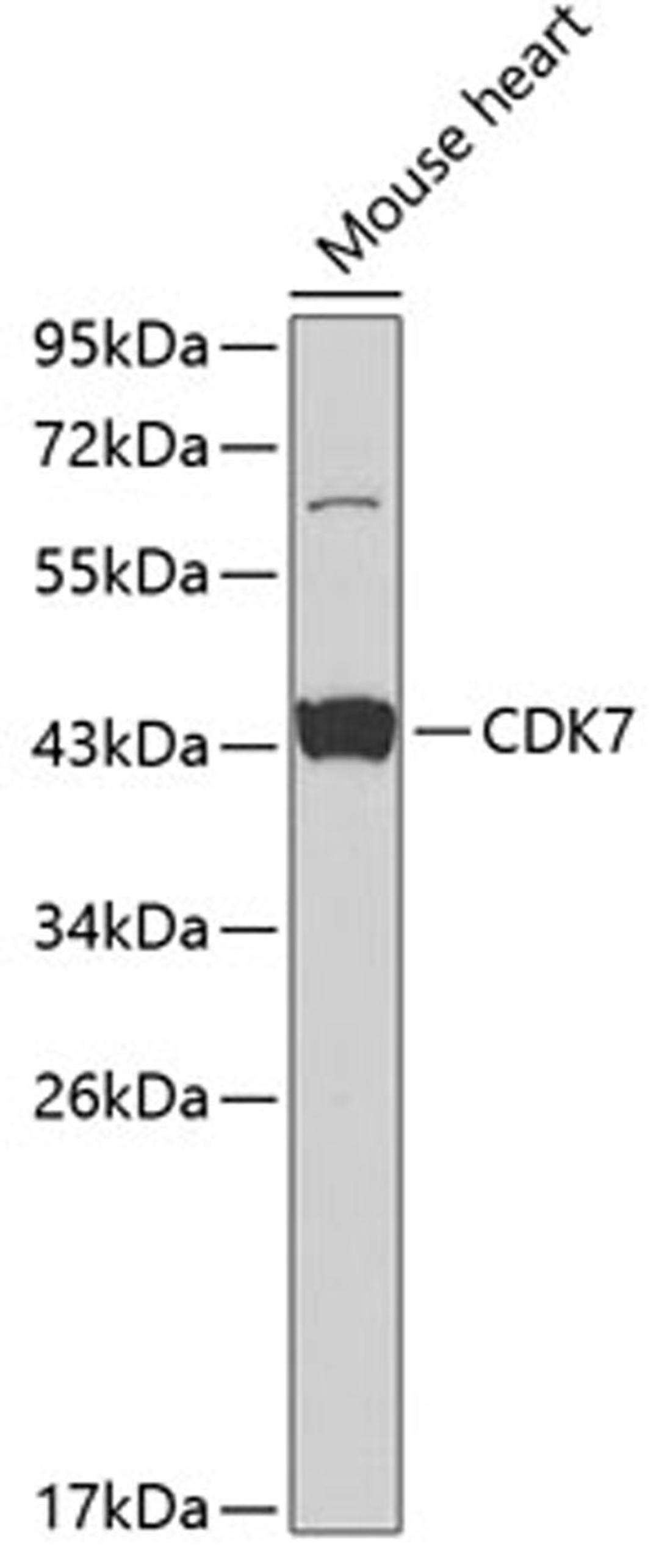 Western blot - CDK7 antibody (A1694)