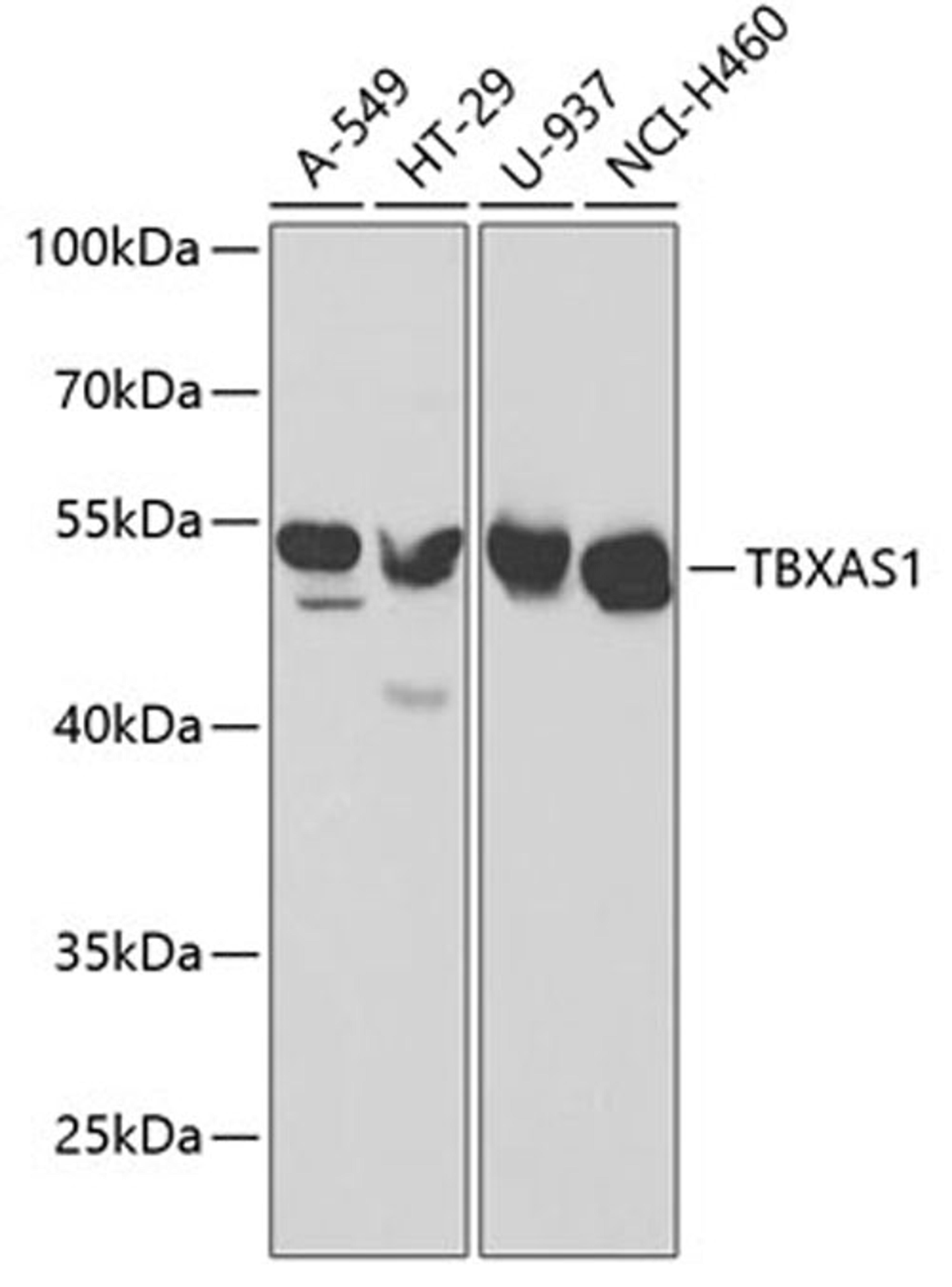 Western blot - TBXAS1 antibody (A1988)