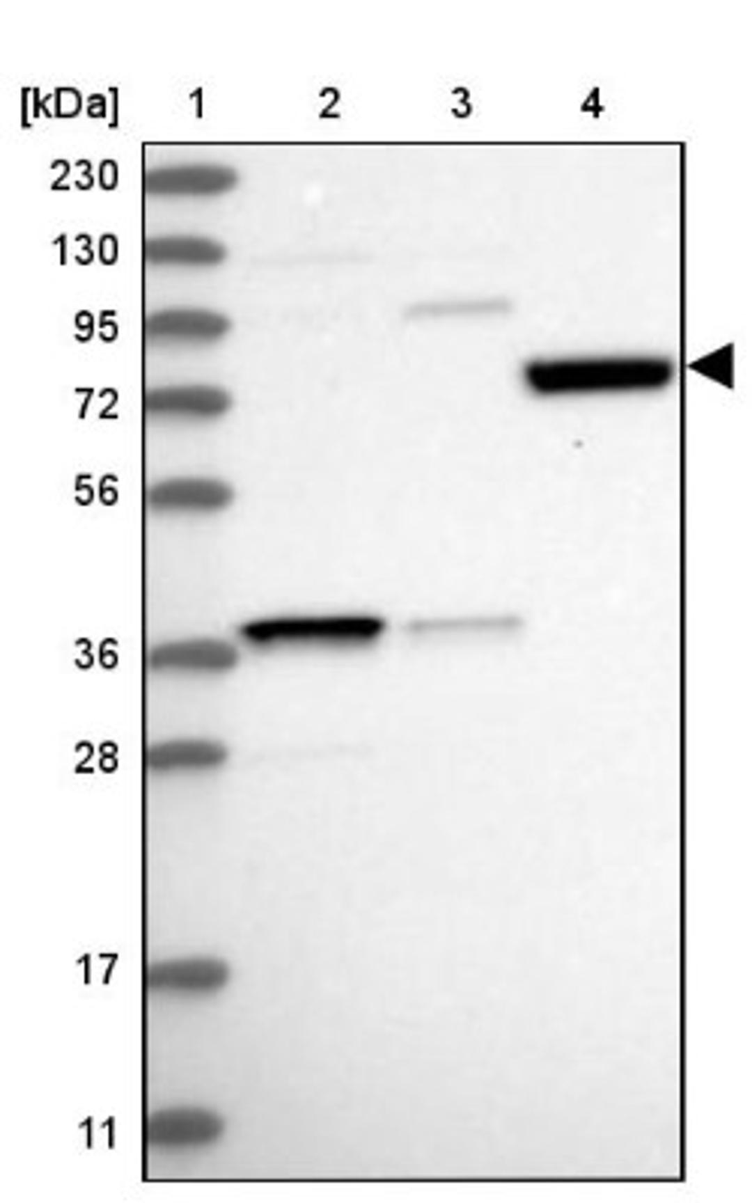 Western Blot: SAMD15 Antibody [NBP1-90726] - Lane 1: Marker [kDa] 230, 130, 95, 72, 56, 36, 28, 17, 11<br/>Lane 2: Human cell line RT-4<br/>Lane 3: Human cell line U-251MG sp<br/>Lane 4: Human plasma (IgG/HSA depleted)